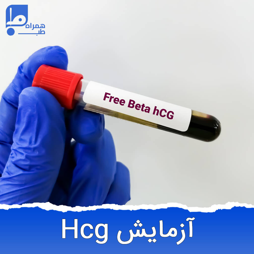 آزمایش HCG برای چیست و باید چند باشد؟