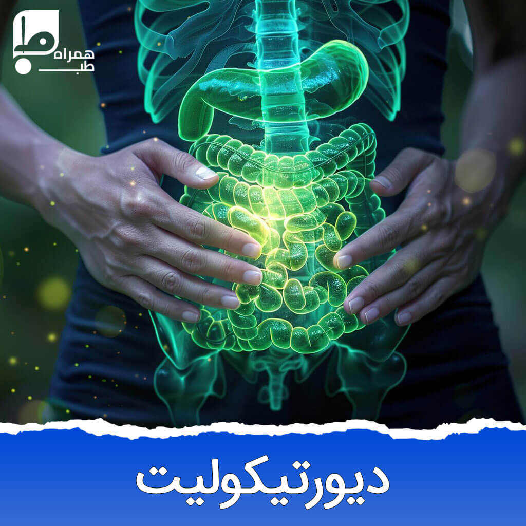 دیورتیکولیت چیست؟ 