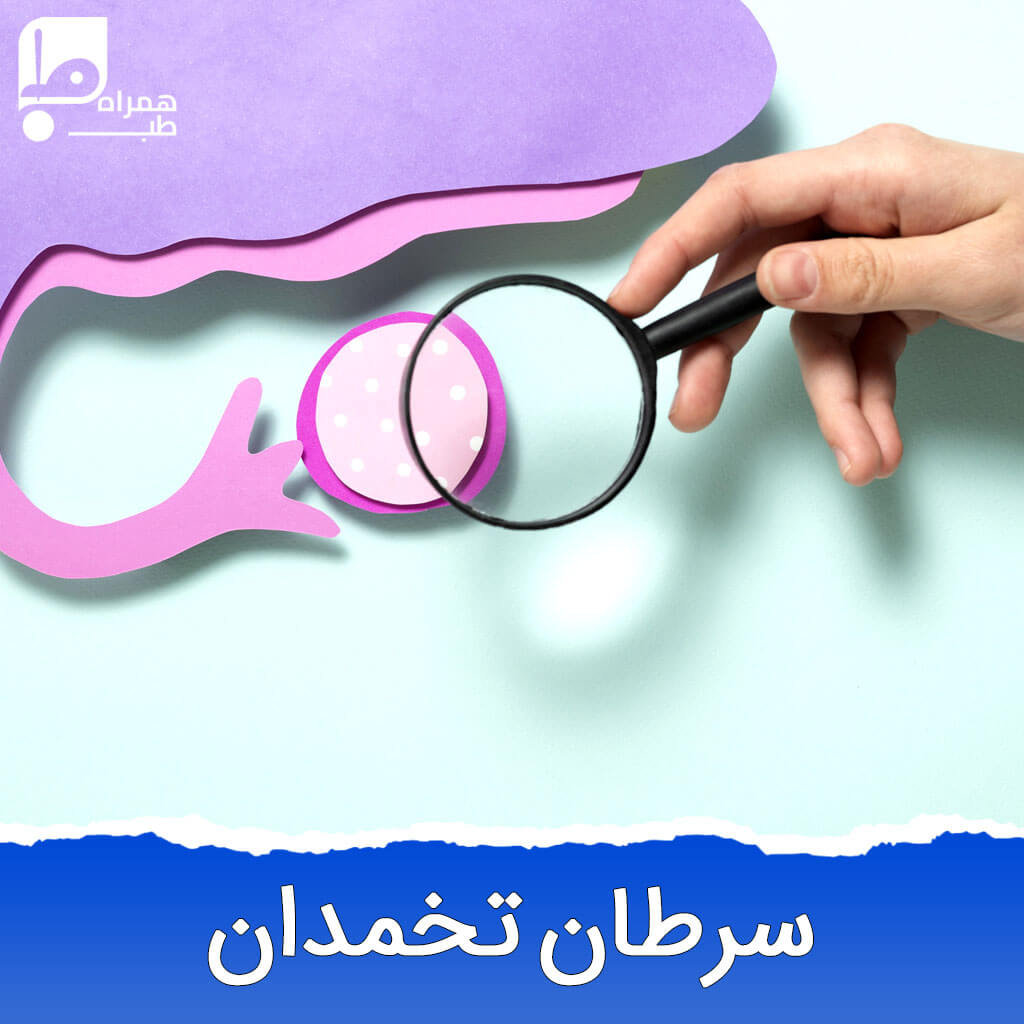 سرطان تخمدان 