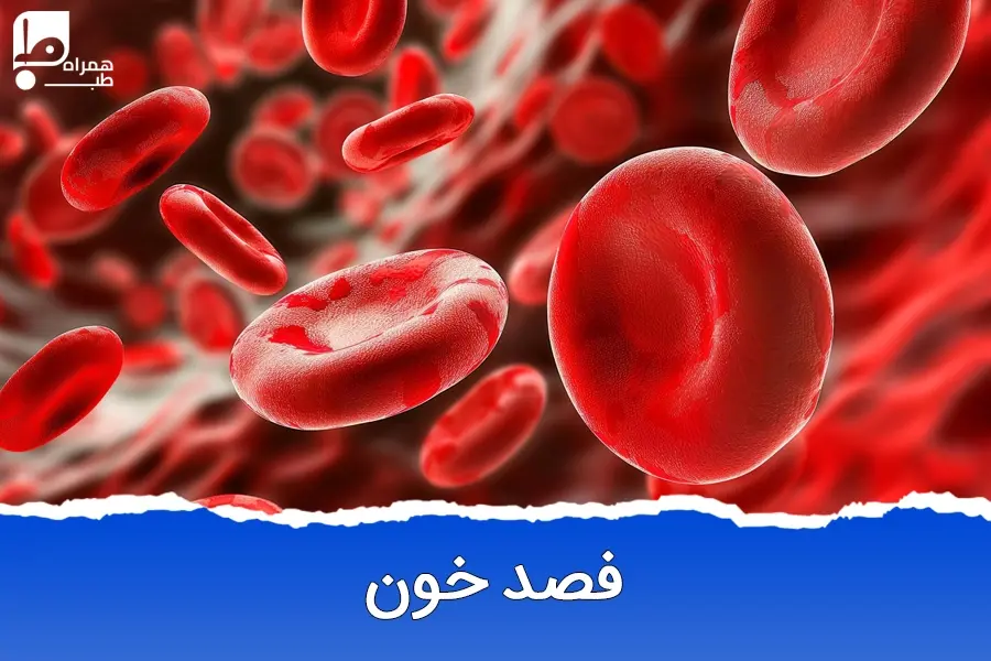 فواید فصد خون در نقاط مختلف بدن از پیشانی تا پا