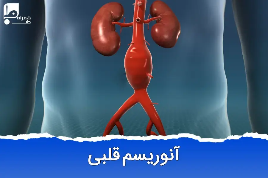 آنوریسم قلبی: علائم، درمان و نکات حیاتی برای سلامت قلب شما