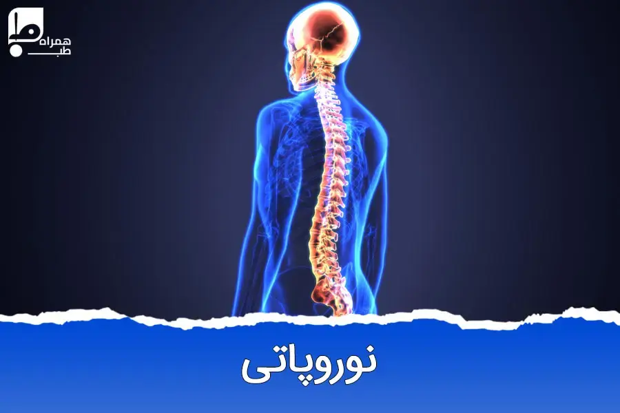 راهکارهای جدید درمان نوروپاتی: از دارو تا روش‌های نوین