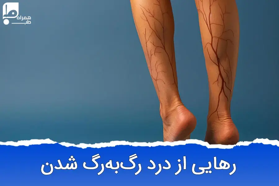 رگ به رگ شدن و راه های درمان آن